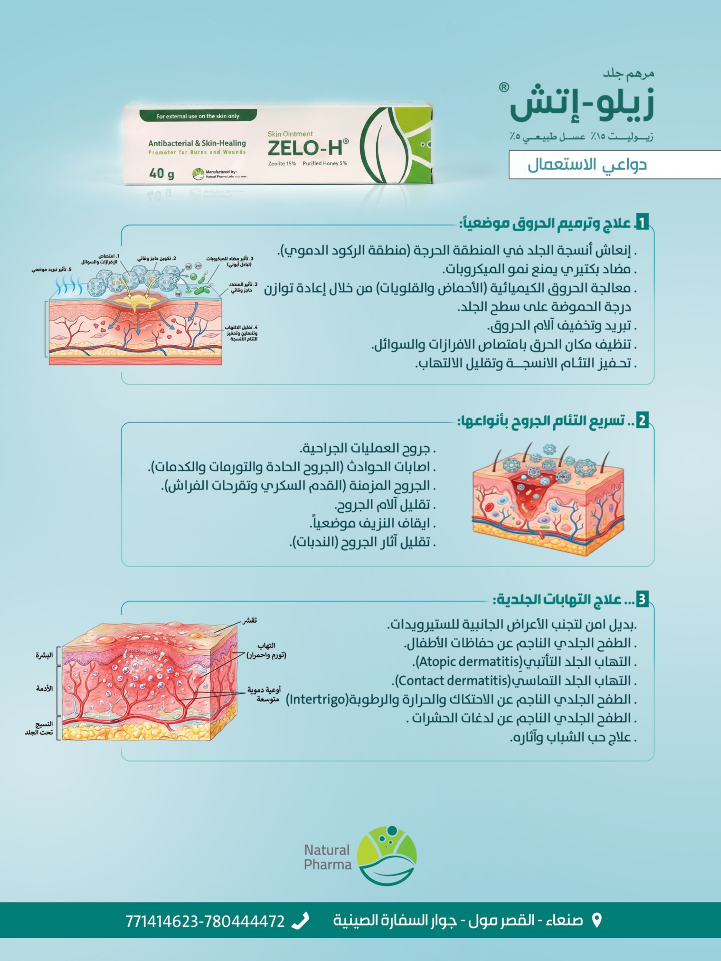 صورة إضافية